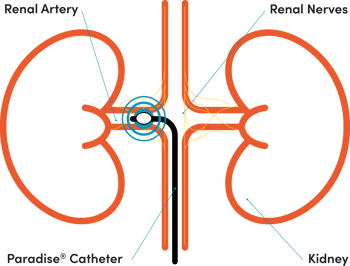 Paradise-uRDN-infographic